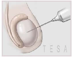 semen analysis